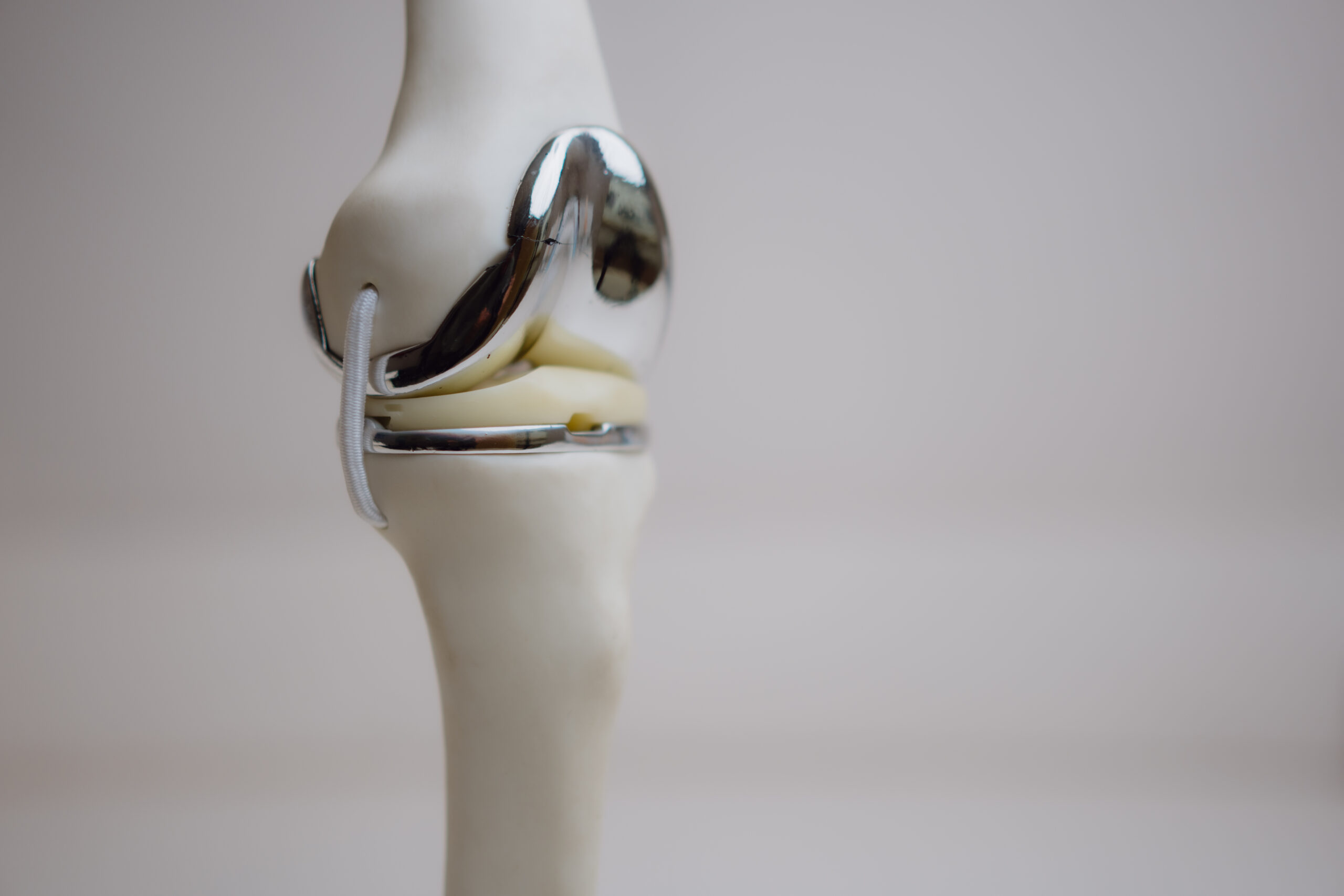 Knee replacement in Kerrville | Muscle sparing knee replacement