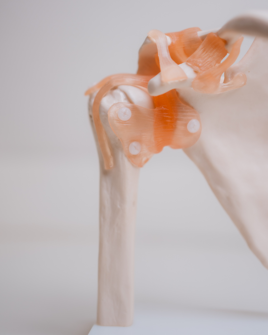Shoulder Replacement in Kerrville