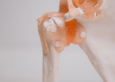Shoulder Replacement Surgeon in Kerrville, Clint Morris MD